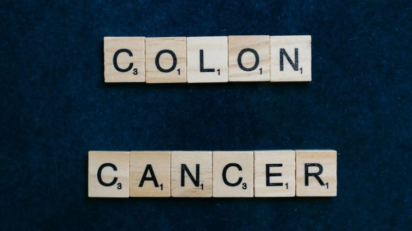 Un semplice esame delle feci rivela al 90% il cancro al colon-retto