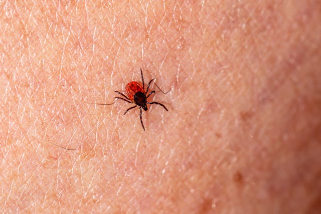 Cos'è la malattia di Lyme di cui Justin Timberlake ha rivelato d'essere affetto?