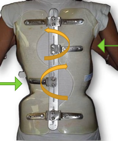 ARTbrace