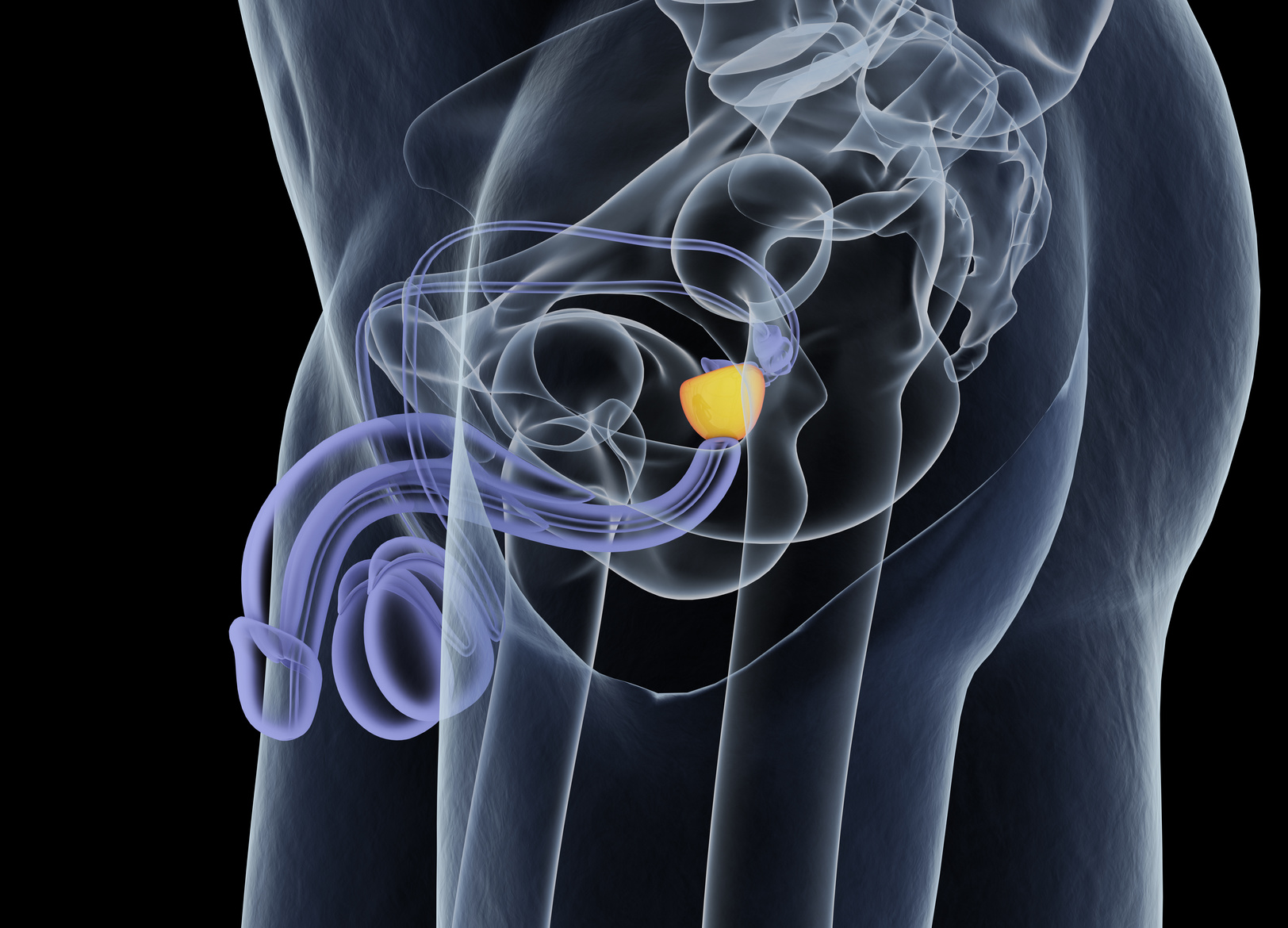 A FIRENZE PER LA PRIMA VOLTA ESEGUITO UN INTERVENTO CON ANESTESIA LOCALE PER L’IPERTROFIA PROSTATICA