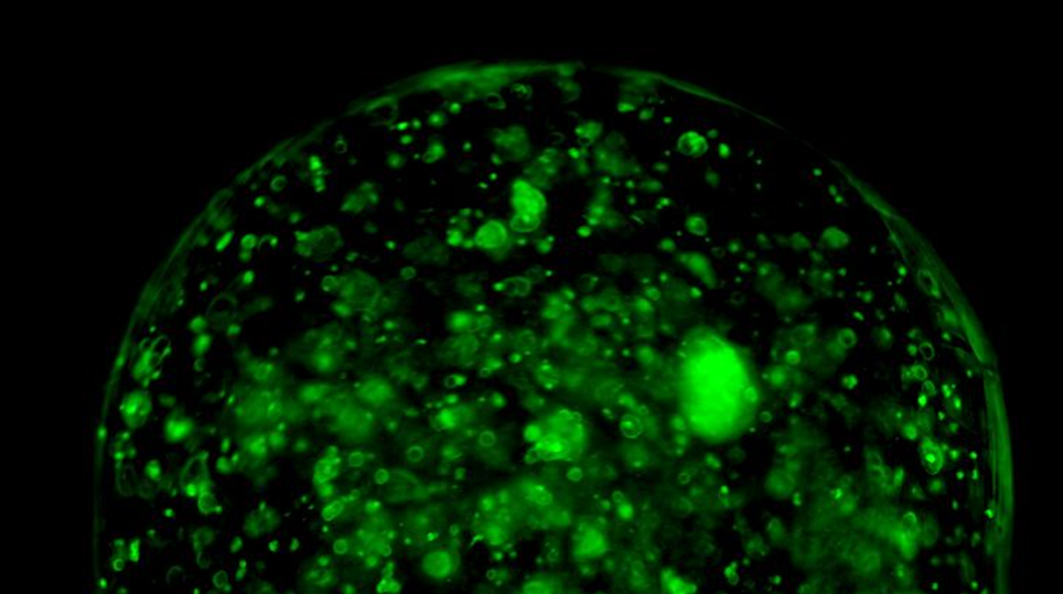 ONDE DI LUCE CONTRO IL CANCRO