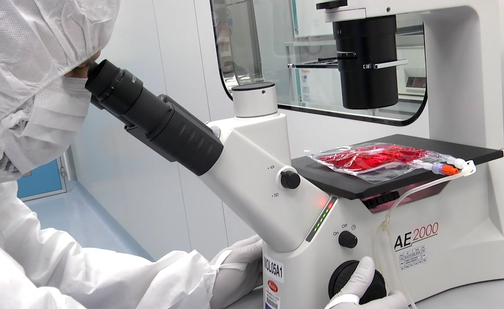 CELLULE CAR T:  TRATTATI I PRIMI TRE PAZIENTI CON MALATTIA AUTOIMMUNE