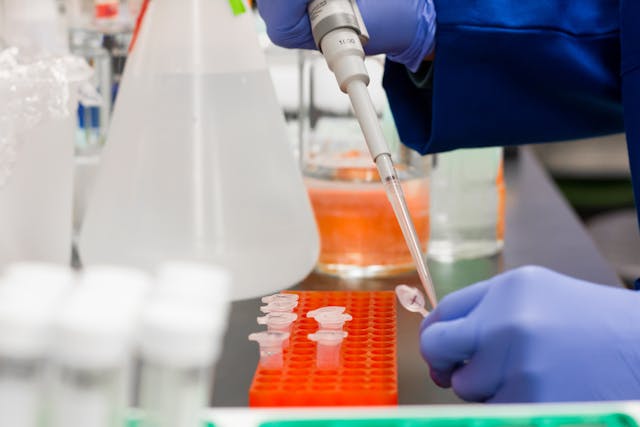 MENARINI: NUOVI DATI SU ORSERDU® NEL CARCINOMA MAMMARIO