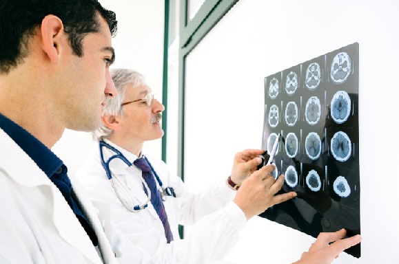 #sepotesseroparlare: la nuova campagna A.L.I.Ce. Italia che dà voce agli oggetti per prevenire l’ictus