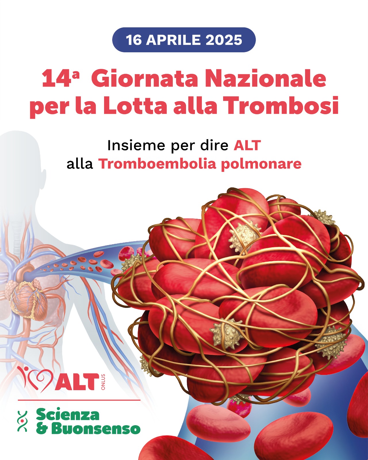 La 14° Giornata Nazionale per la Lotta alla Trombosi dedicata alla tromboembolia polmonare