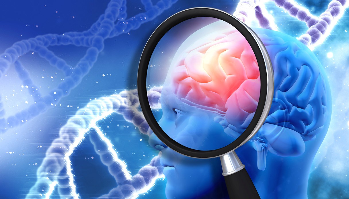 L’EMA autorizza il farmaco lecanemab contro l’Alzheimer