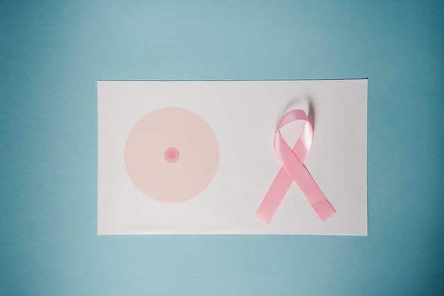 Carcinoma mammario, le innovazioni nei trattamenti sempre più personalizzati
