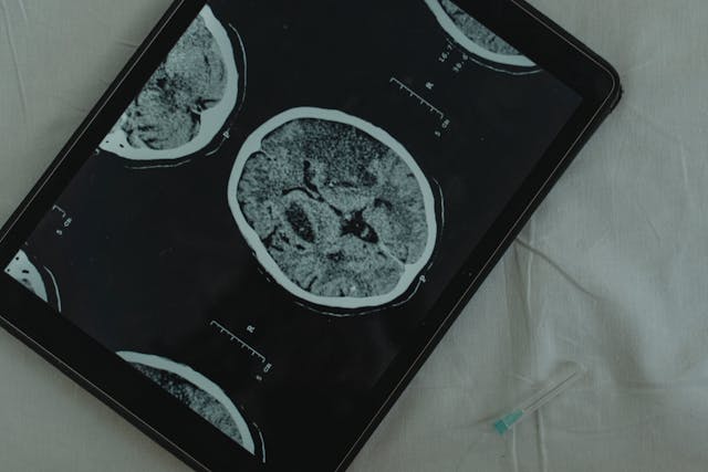 Il legame tra la microglia e la memoria