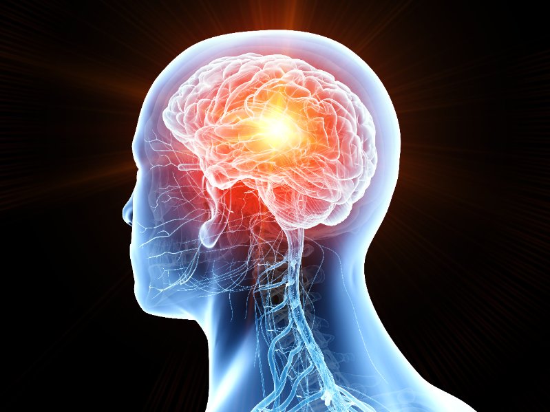 Tumori al cervello: diagnosi più veloce con un test