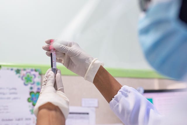 Effetti collaterali di finasteride e dutasteride