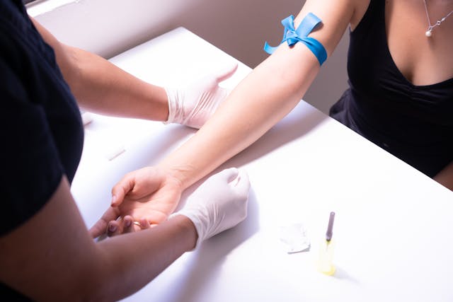 50mila diagnosi mancate nel 2023 per scarsa adesione a screening