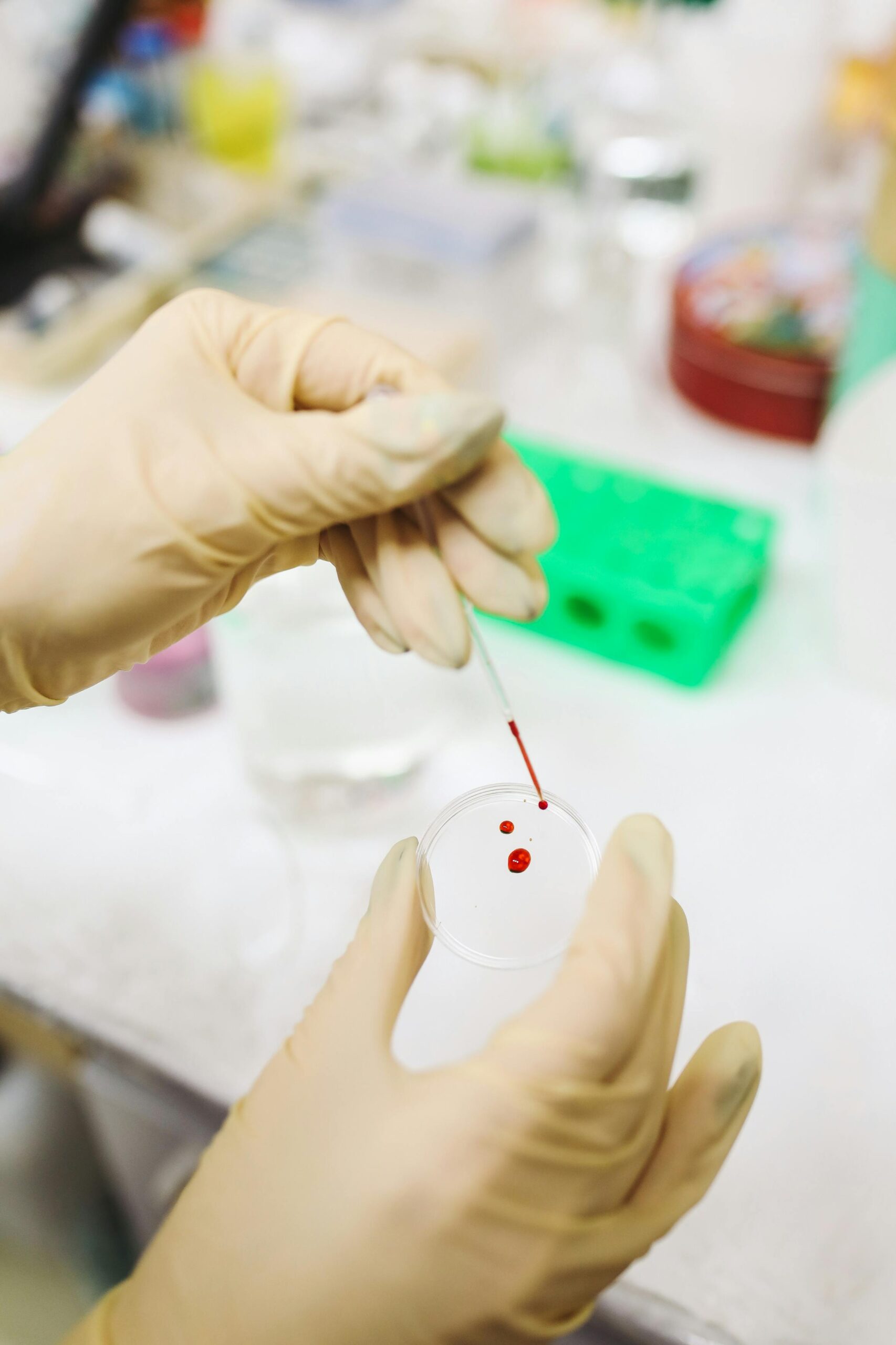 Una goccia di futuro: il test del sangue che rivoluziona la diagnosi dell’Alzheimer