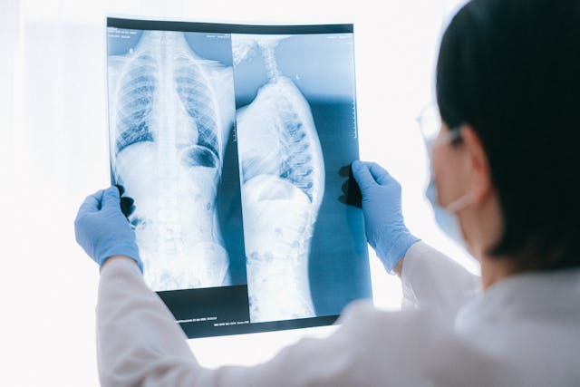 Con una TAC diagnosi precoce per ridurre mortalità e costi del cancro ai polmoni