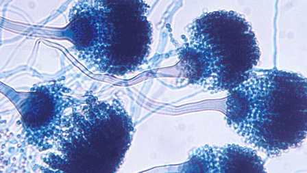 Le infezioni fungine sono sempre più difficili da curare