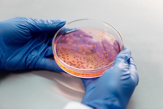 Superbatteri, la minaccia globale: entro il 2050 milioni di morti e costi record