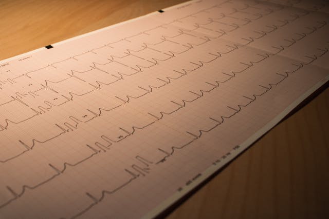 Cardiologia: negli Stati Uniti negli ultimi 50 anni le morti per infarto diminuite del 90%